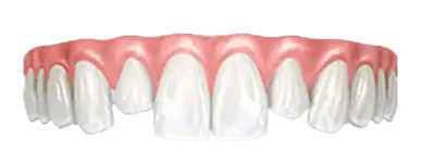 Разная длина зубов