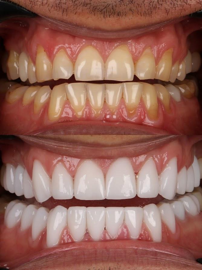 Результат 1