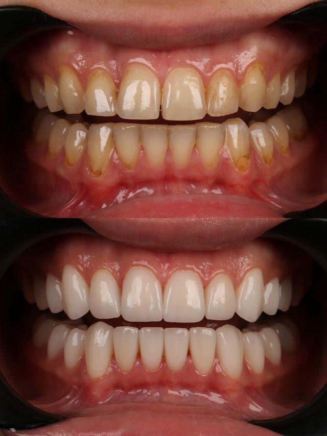 Результат 4