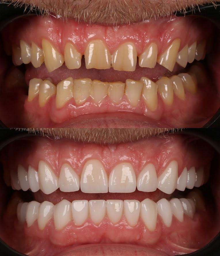 Результат 2