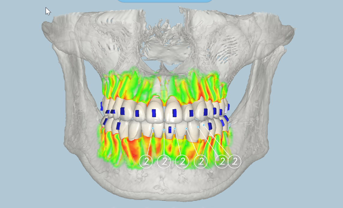 OrthoCheck Visualization